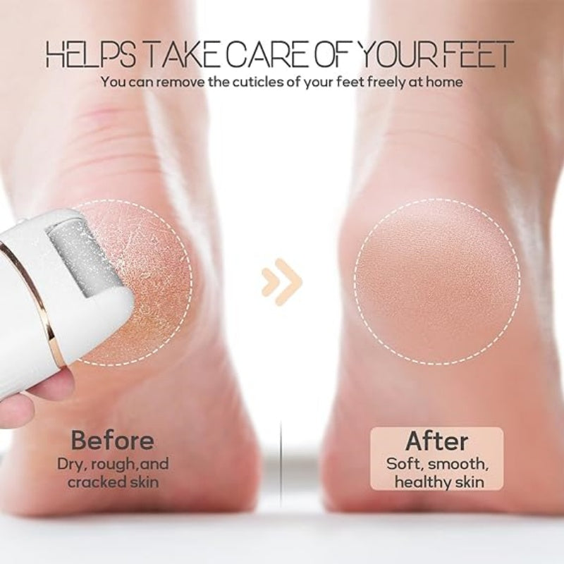 Automatic Callus Remover for Feet