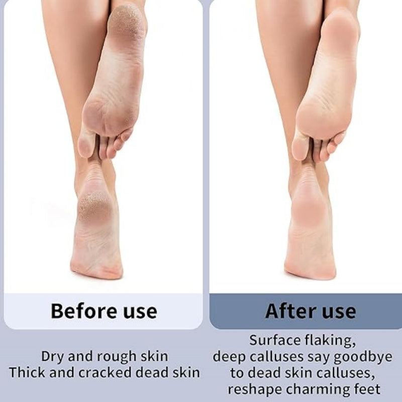 Automatic Callus Remover for Feet